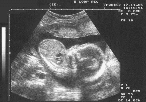 Fetal Ultrasound - Full size.jpg