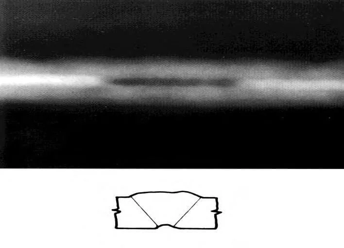RADIOGRAPHY FILM INTERPRETATION