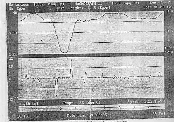 NON-DESTRUCTIVE TESTING OF STEEL WIRE ROPES AND THEIR DISCARD CRITERIA