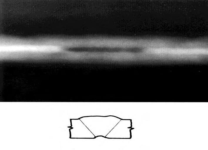 RADIOGRAPHY FILM INTERPRETATION