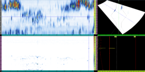 Phased Array Ultrasonics weld scan