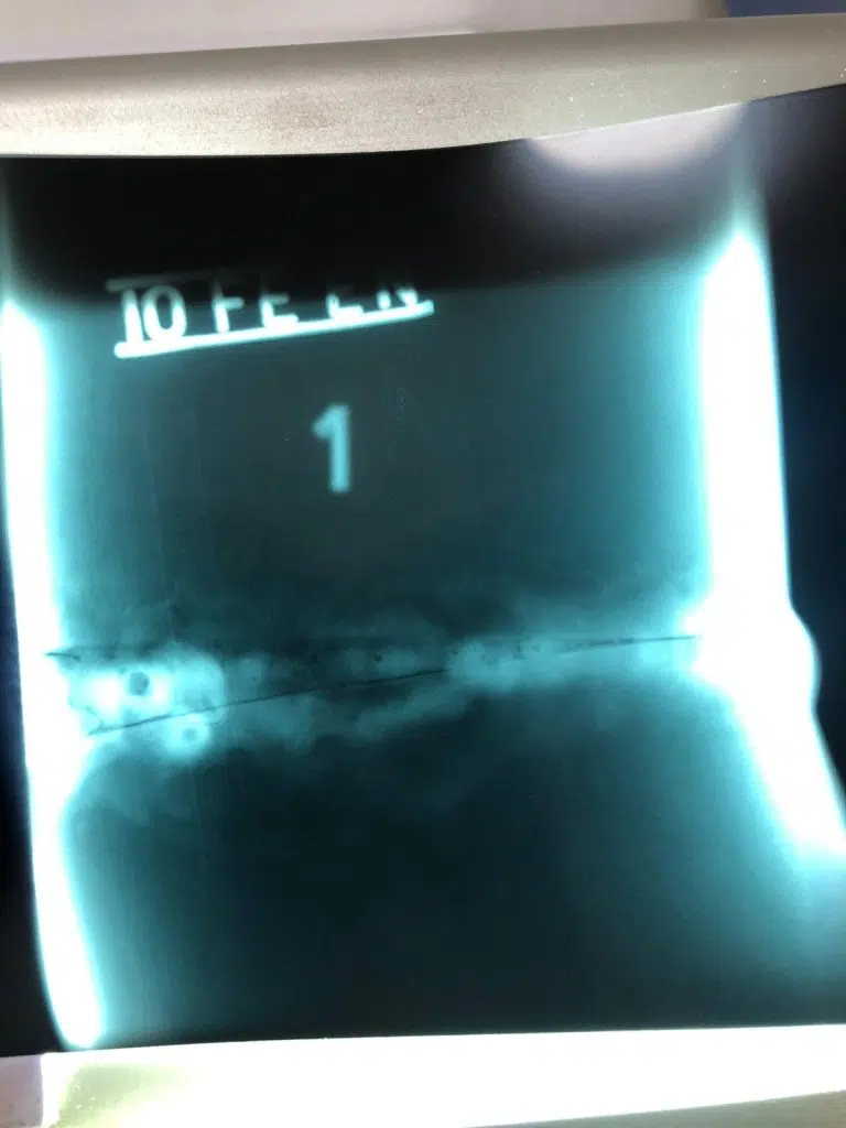 What is NDT (Non-Destructive Testing) and Inspection Methods What is NDT (Non-Destructive Testing) and Inspection Methods